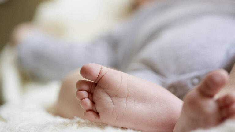 Espero um bebê com malformações que não sobreviverá. O que faço?